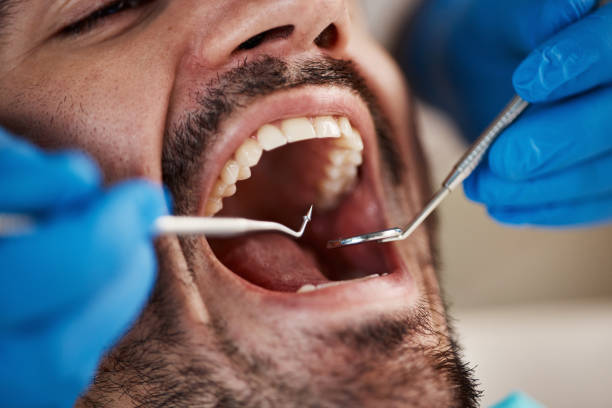 Fast & Reliable Emergency Dental Services in CT